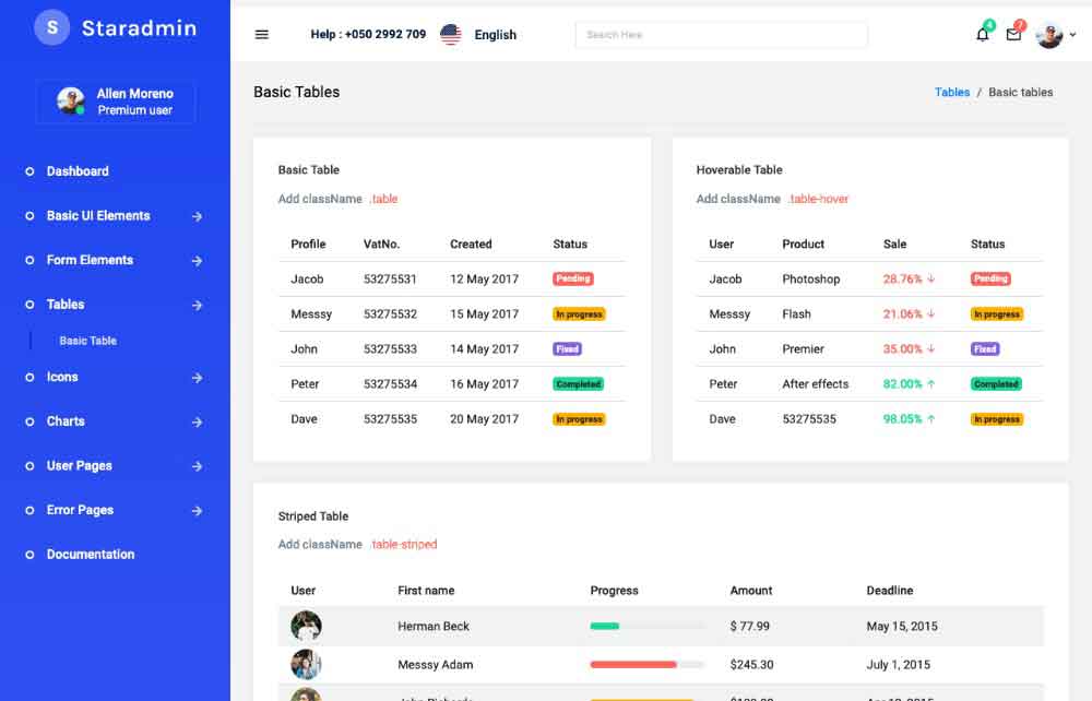 Table options available in Star admin react free admin template